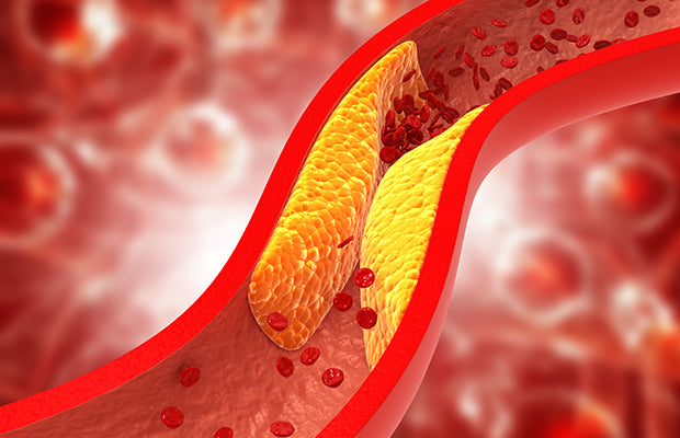 Taming Cholesterol the Natural Way